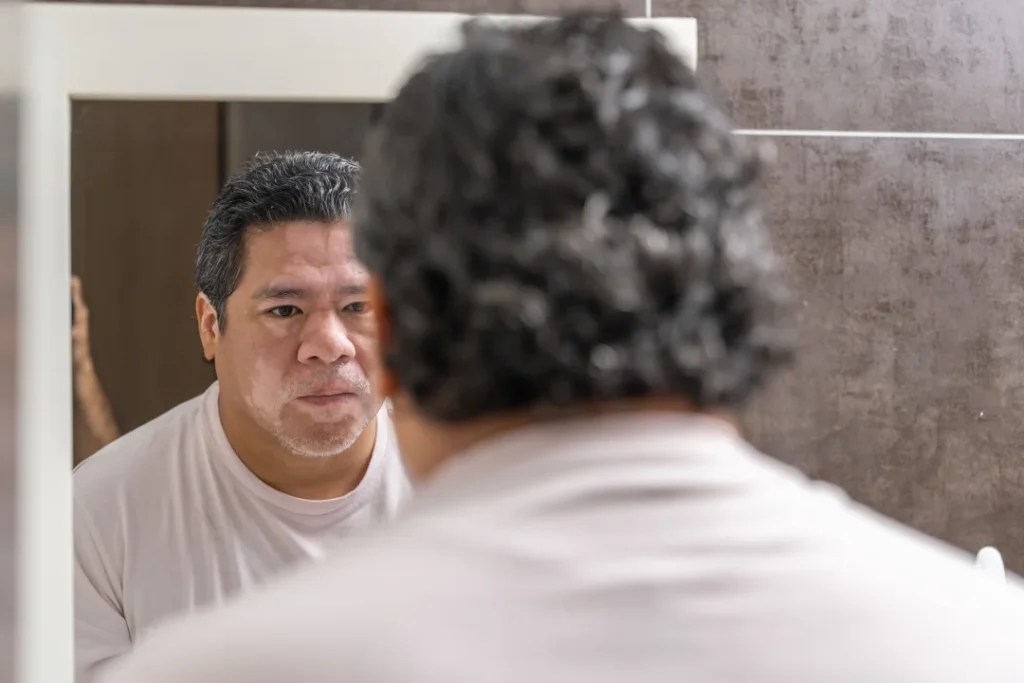 The Grove Recovery | man with vitiligo looking on the mirror in the bat 2026 01 08 06 33 03 utc
