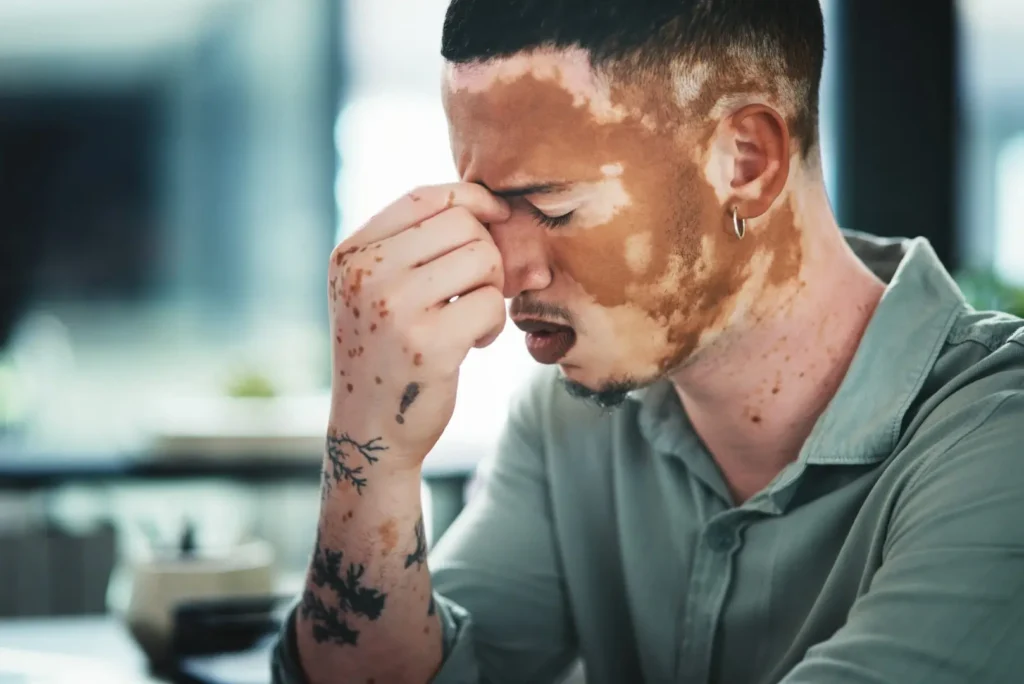 The Grove Recovery | headache eye strain or man in office with pain t 2026 05 20 17 20 13 utc